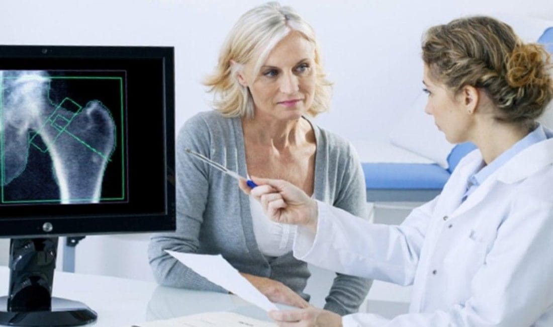 Kemik Sağlığınızı Korumak İçin Uzmanından Öneriler Kemik erimesi olarak bilinen