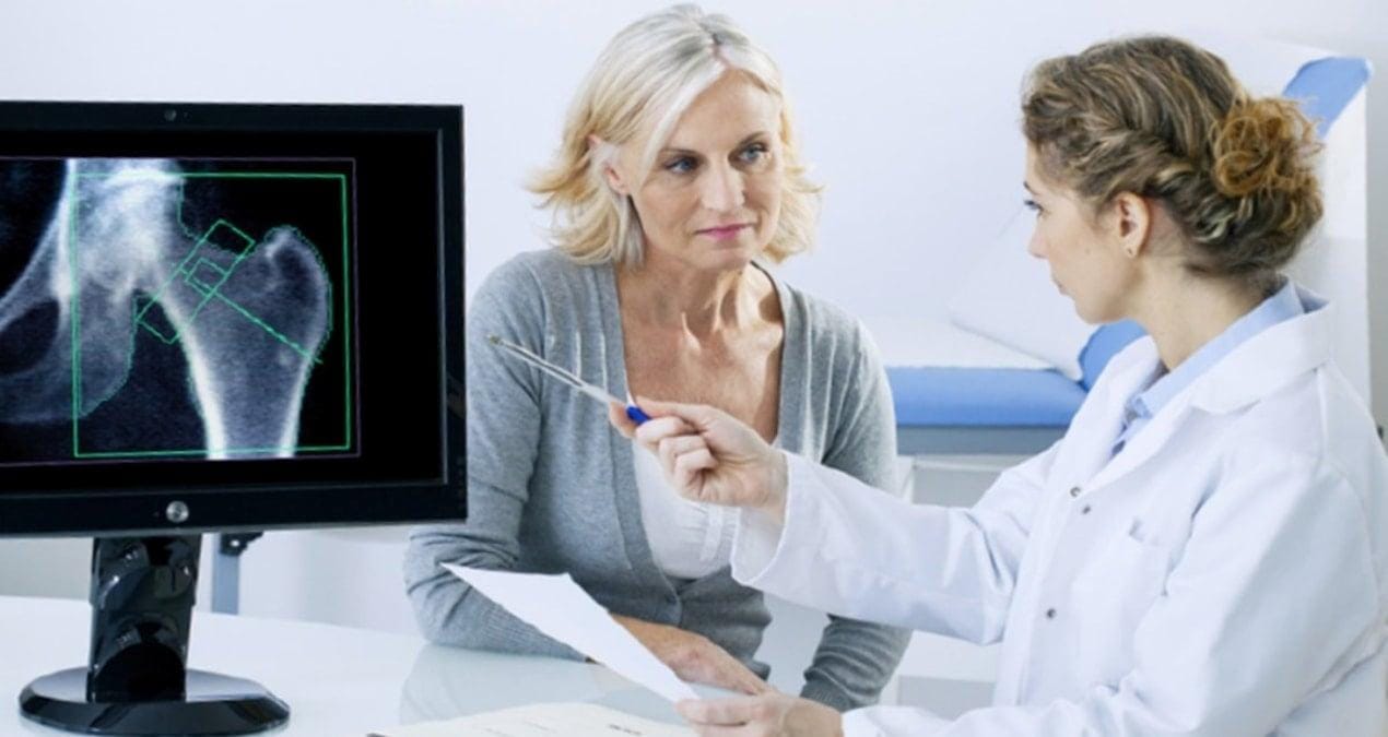 Kemik Sağlığınızı Korumak İçin Uzmanından Öneriler Kemik erimesi olarak bilinen