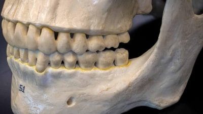 Paranthropus robustus’ta Paleoproteomik Bulgu: Erken Hominin Çeşitliliğine Yeni Bir Bakış