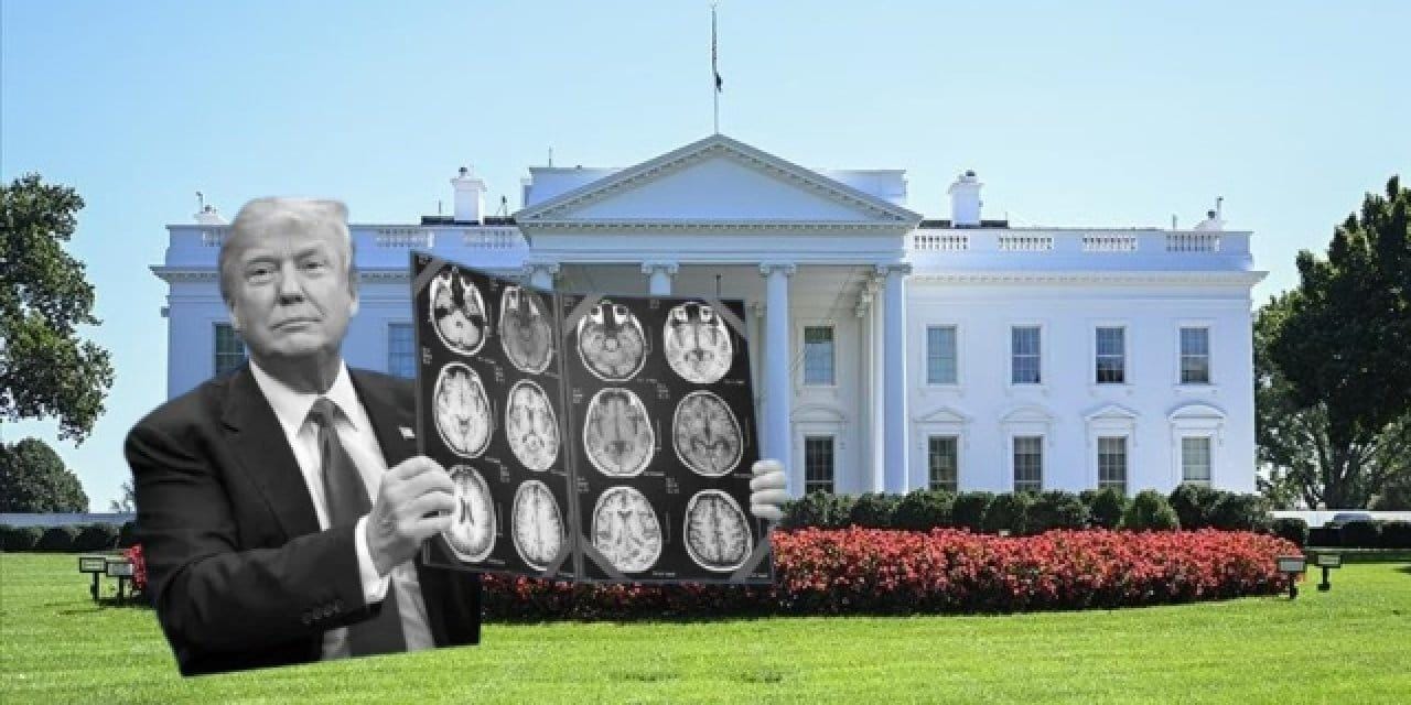 mental-yeterliligi-sorgulanmisti-trumpin-beyin-emari-paylasilacak-xl28AGIW.jpg