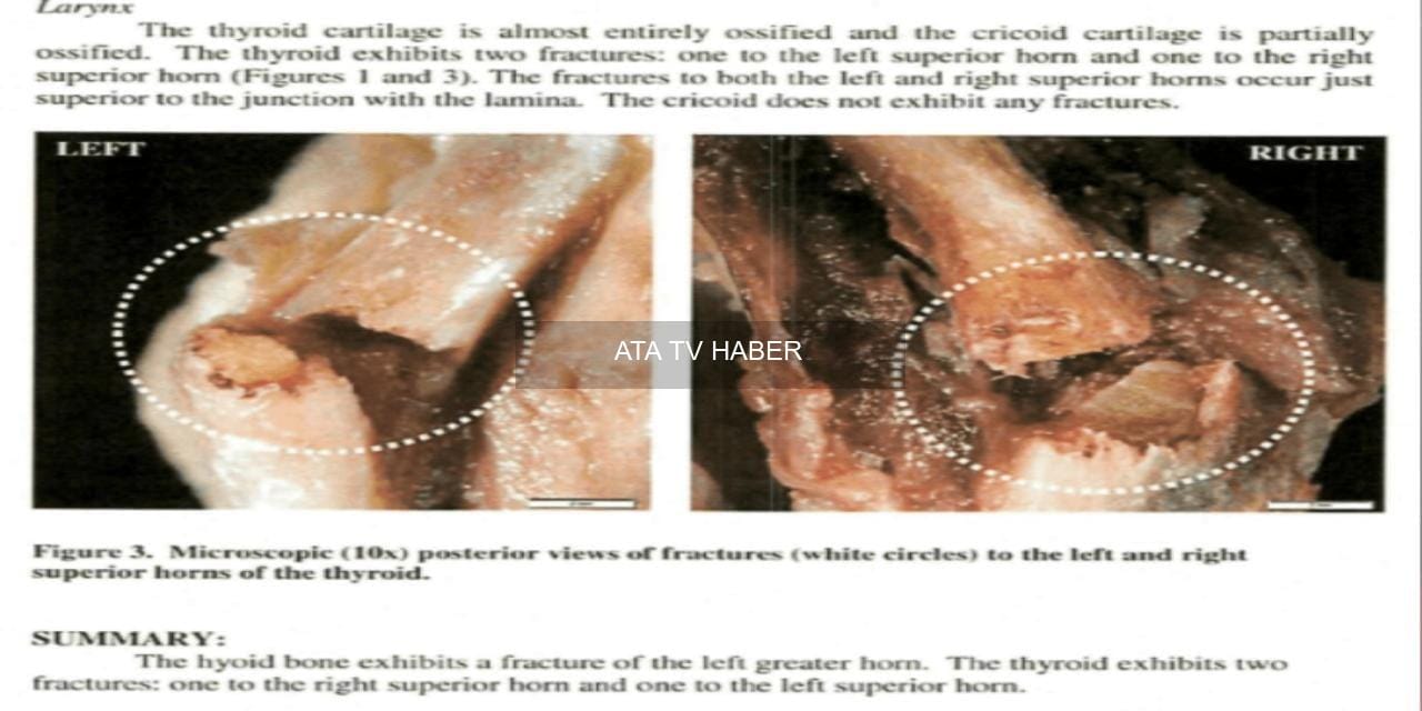 Jeffrey Epstein’ın Ölümü: Adalet Bakanlığı Belgeleri ve Yeni Fotoğraflarla Olayın Ayrıntıları