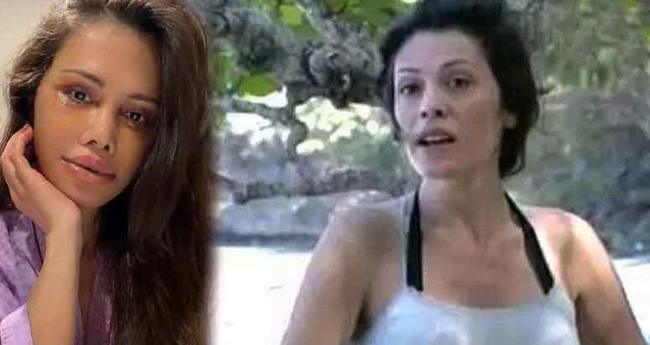 Didem Ceran’ın Yüz ve Estetik Operasyon Süreci: İki Günden Oluşan