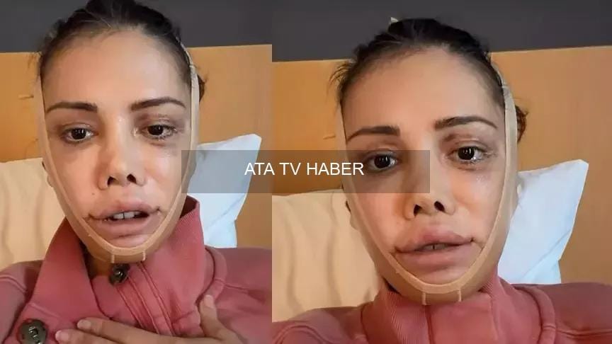 Didem Ceran'dan hayranlarını üzen sağlık haberi