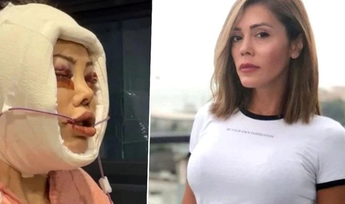 Didem Ceran’dan hayranlarını üzen sağlık haberi Yıllar önce katıldığı oryantal