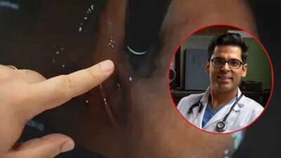 Gastroenterolog Dr. Saurabh Sethi’den Bağırsak Sağlığı İçin 4 Temel Öneri