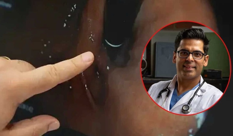 Harvardlı Doktor ‘detoksa gerek yok’ dedi, bağırsakları genç tutmanın 4 formülünü verdi