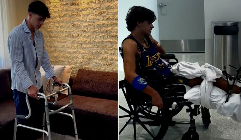 Survivor’da bacağını kaybeden yarışmacı yürüyüşe başladı: Yeni hayatına alışıyor